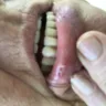 Aspen Dental - dentures - Photo 1