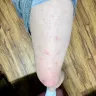 Days Inn - bed bugs and fleas in carpet - Photo 2