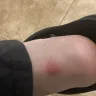 Costco - employee overfilling of customer cart/ lady hurt me - Photo 2