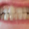Pfizer - tetracycline staining of the teeth - Photo 1