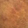 Sandals Resorts - bed bug infestation - Photo 6