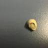 Aspen Dental - I received a crown it was put in incorrectly it broke my tooth now I need a implant - Photo 1