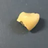 Aspen Dental - I received a crown it was put in incorrectly it broke my tooth now I need a implant - Photo 2