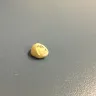 Aspen Dental - I received a crown it was put in incorrectly it broke my tooth now I need a implant - Photo 4