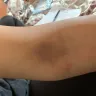 LabCorp - blood work - Photo 3