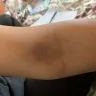 LabCorp - blood work - Photo 1