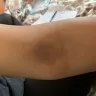 LabCorp - blood work - Photo 2