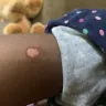 The Cheesecake Factory - burns on child from pizza - Photo 2