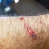 KFC - door cut my arm open