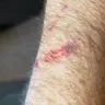 KFC - door cut my arm open