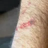 KFC - door cut my arm open - Photo 2