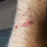 KFC - door cut my arm open