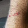 KFC - door cut my arm open - Photo 1