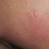 Kampgrounds Of America [KOA] - I was eating up by bed bugs - Photo 4