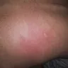 Kampgrounds Of America [KOA] - I was eating up by bed bugs - Photo 1