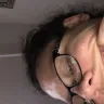 Aspen Dental - Root canal/ cap gone wrong - Photo 2