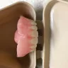 Aspen Dental - Upper dentures