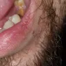 Western Dental Services - dental work - Photo 4