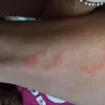 Motel 6 - bed bugs - Photo 1