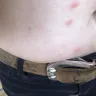 Motel 6 - bed bugs - Photo 4