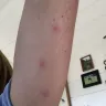 Motel 6 - bed bugs - Photo 2