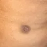 Sono Bello - botched procedure - Photo 4