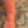 Royal Caribbean Cruises - Fleas in cabin/compensation for a ruined week of cruise/vouchers without permission - Photo 3
