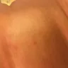 Royal Caribbean Cruises - Fleas in cabin/compensation for a ruined week of cruise/vouchers without permission - Photo 5