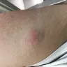 Americas Best Value Inn - bed bugs room 130 - Photo 1