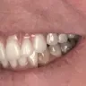 Aspen Dental - Dentures - Photo 1