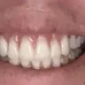 Aspen Dental - Dentures - Photo 2