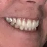 Aspen Dental - Dentures - Photo 3