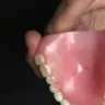 Aspen Dental - I am still wearing temporary denture with my name embedded in them. - Photo 1