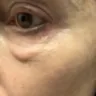 Patrick K Sullivan - cosmetic surgery - Photo 1