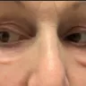 Patrick K Sullivan - cosmetic surgery - Photo 3
