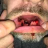 Aspen Dental - Bad extraction, mislead on products receiving, refused medical documents, dentures are wrong and will not replace - Photo 1