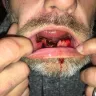Aspen Dental - Bad extraction, mislead on products receiving, refused medical documents, dentures are wrong and will not replace - Photo 2