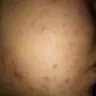 Murad - blemish control kit - Photo 1