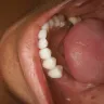 Cancun Cosmetic Dentistry - horrible work and infection - stay as far away from these people as you can!!! run far away!!! crooked and unprofessional.