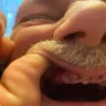 Aspen Dental - Teeth extractions, ripoff - Photo 2