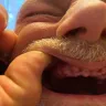 Aspen Dental - Teeth extractions, ripoff - Photo 1