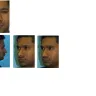Dr. Anil R. Shah, MD - Changed his plan just before the surgery - Photo 1