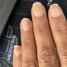 Sorbet Group - Nail treatment - Photo 2