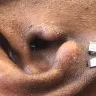 Beats By Dre - Infection - Photo 1