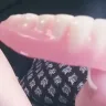 Aspen Dental - Dentures - Photo 3
