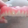 Aspen Dental - Dentures - Photo 6