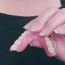 Aspen Dental - Dentures - Photo 5