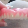 Aspen Dental - Dentures