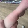 Morrisons - Negligence to maintain trolleys used by customers - Photo 3