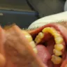 Secure Dental Davenport IA - Dental services